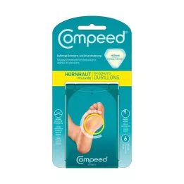 COMPEED Kalusová omietka, 6 kusov